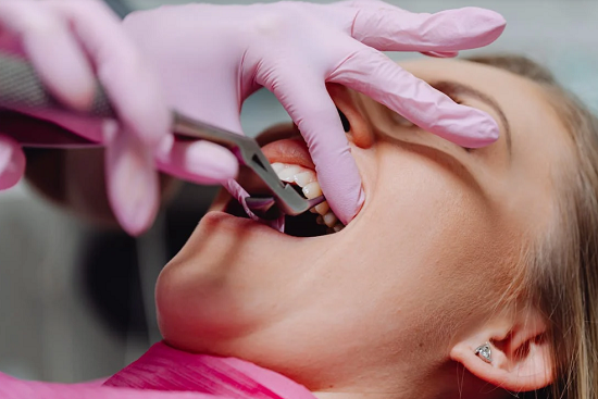 Kiek kainuoja dantų tiesinimas?