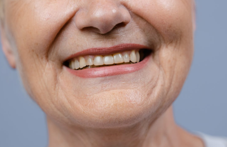 Dantų implantavimo eiga – ko tikėtis prieš ir po procedūros?