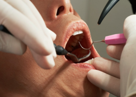 „Dantistas“ – visos dantų priežiūros paslaugos vienos klinikos specialistų rankose