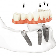 Odontologija Jums, UAB