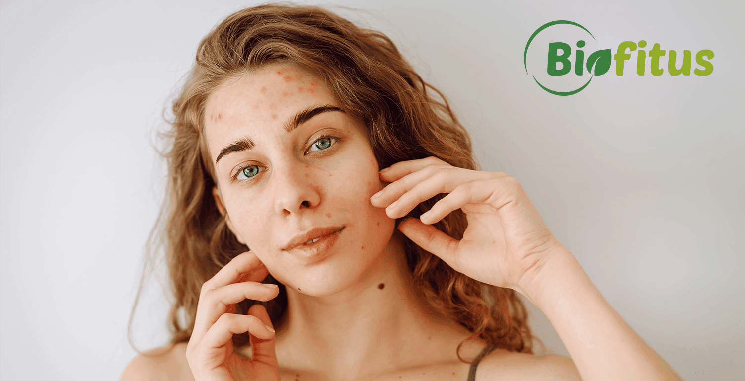 Kaip pagerinti odos elastingumą ir išvaizdą? Biofitus patarimai