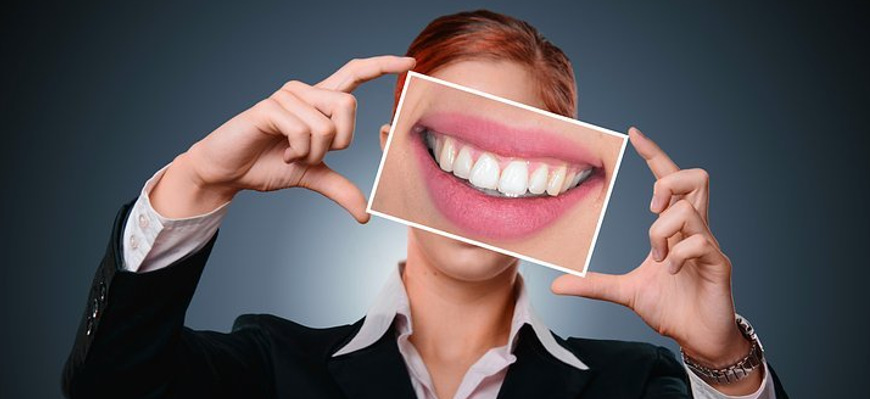 Dantų implantacija: kaip ši procedūra pakeitė pacientų gyvenimus?