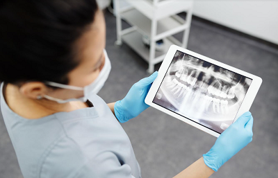 Ar būtina atlikti burnos higieną?