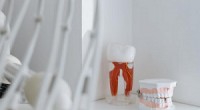 Dantų protezų tipai